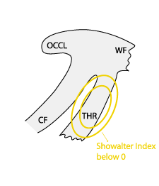 thickness_ridge_cloudiness